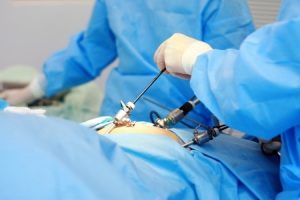 laparoscopy in indore