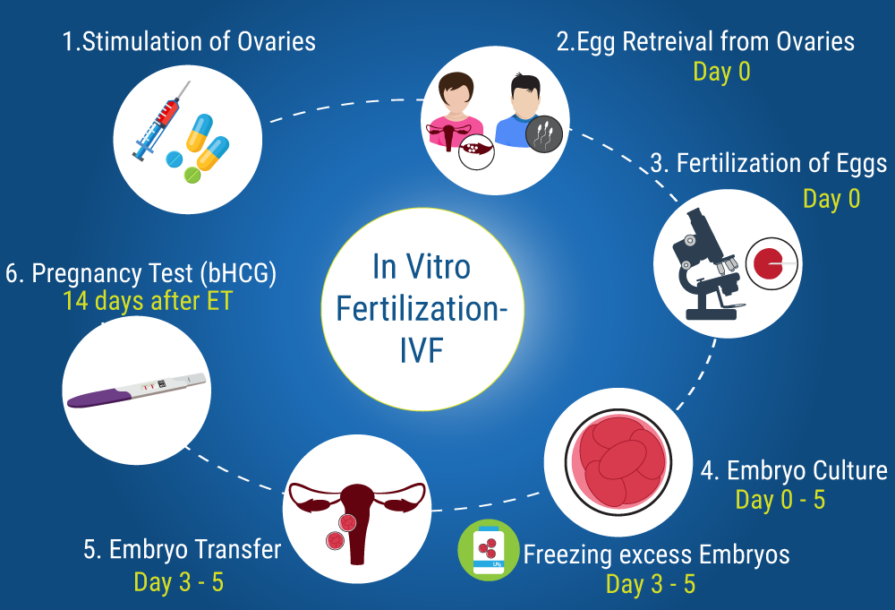 IVF Steps