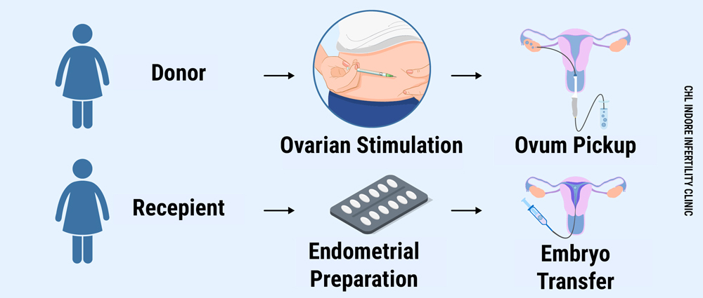 Ivf With Donor Sperm