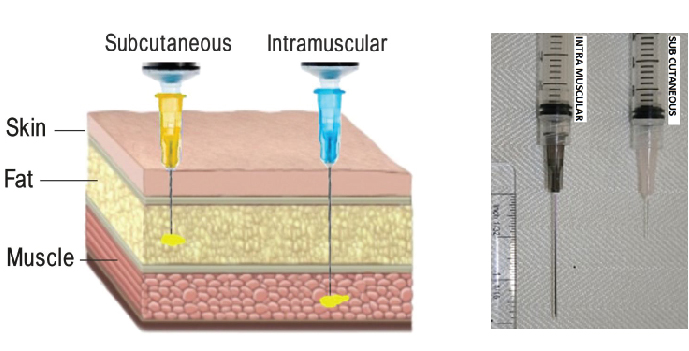 types of injection subcutaneous vs intramuscular
