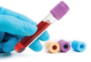 FemaleInfertilityBloodTest