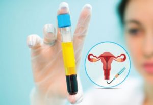 PRPTherapyFertilityTreatment