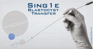 elective single embryo transfer