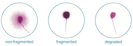 Sperm dfi dna fragmentation