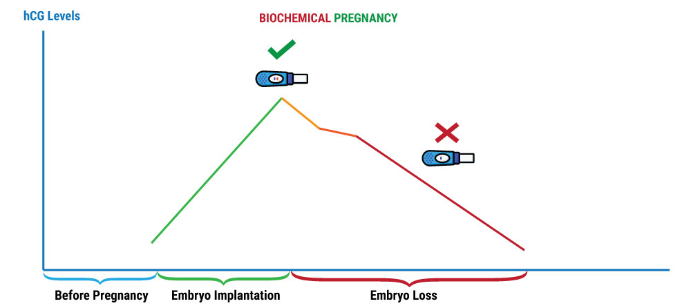 biochemical pregnancy hcg