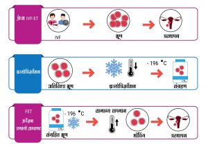 आईवीएफ सम्बंधित कुछ परिभाषाएं