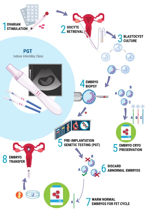 ivf pgt cycle