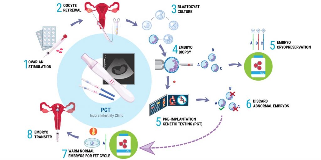 ivf pgt cycle