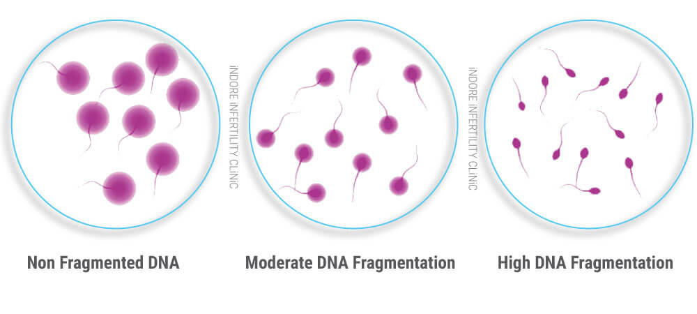 SpermDNAFragmentationTest