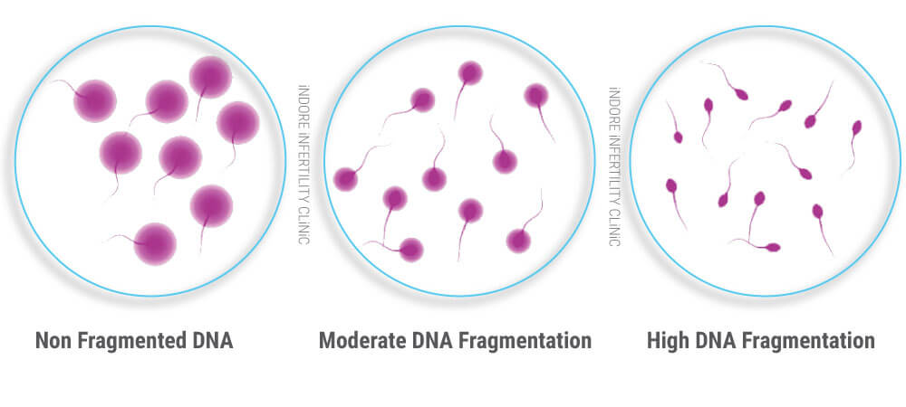 sperm dna fragmentation