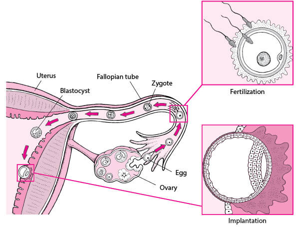 EctopicVsNormalPregnancy