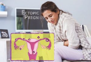 ectopic pregnancy