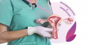 InfertilityAndEndometriosis