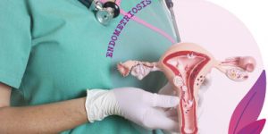 Infertility&Endometriosis