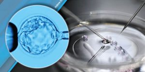 EmbryoBiopsyPGTTest