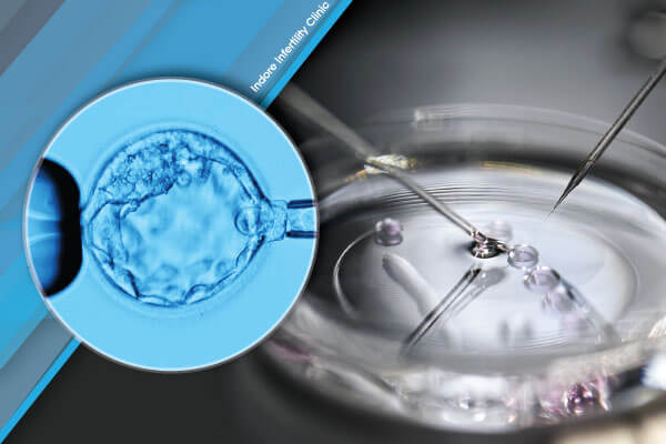 Should I consider Genetic Testing of Embryos
