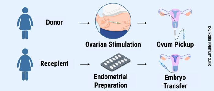 egg donation process