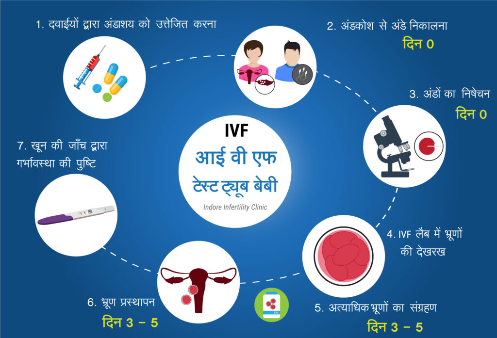 IVF steps in hindi