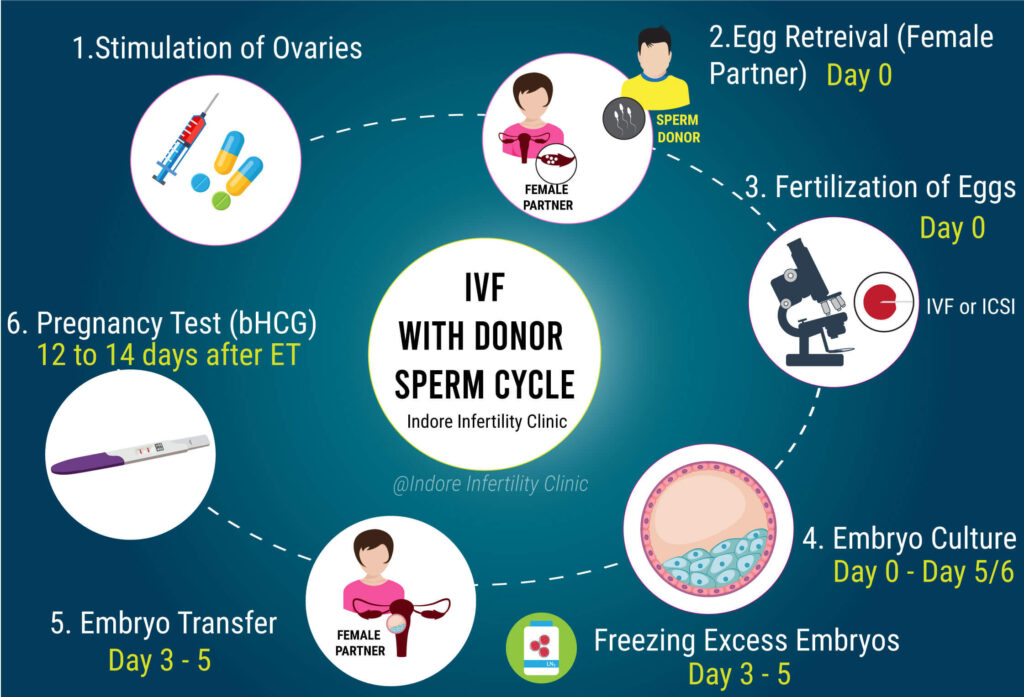 ivf with donor sperm steps