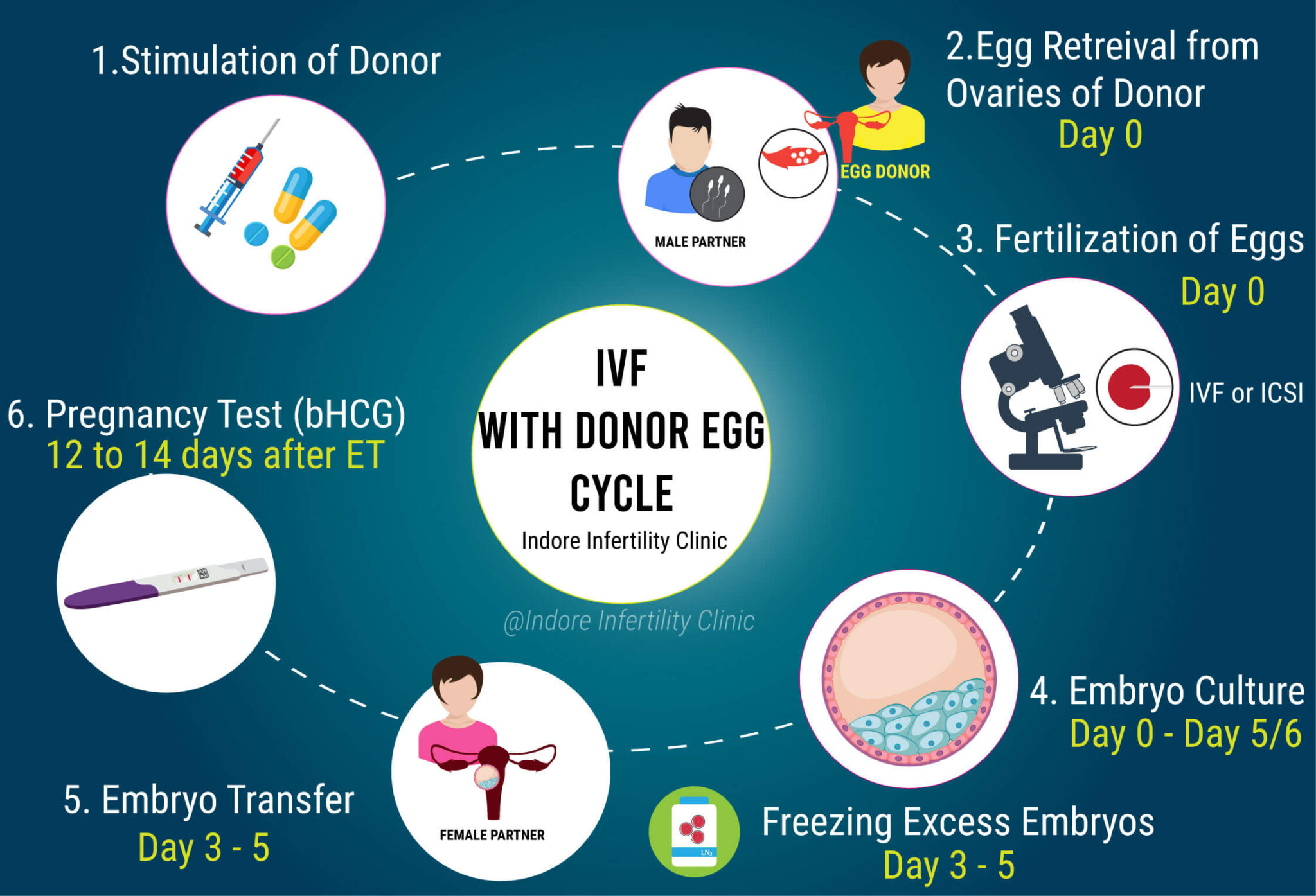 IVF with Donor Egg cost in Indore Indore Infertility Clinic