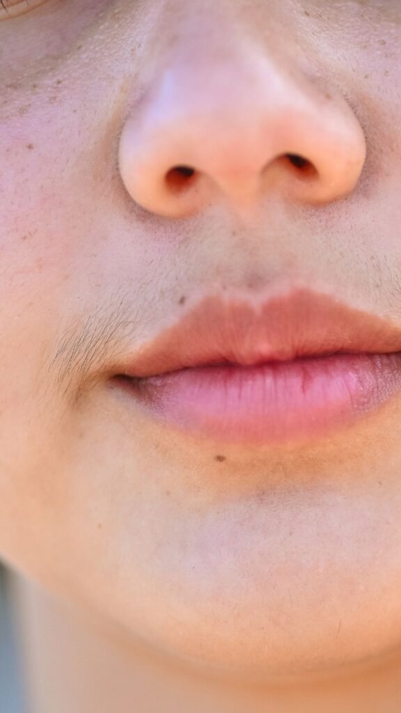 women facial hair Get best solution on IVF at IVF Center Indore 1