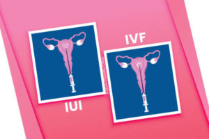 IUI Vs IVF Difference