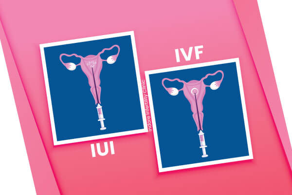 What’s the Difference Between IUI and IVF