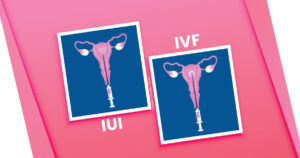 Difference Between IUI and IVF