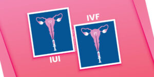 iui or ivf