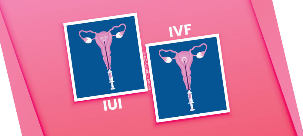 IUI और IVF में अंतर
