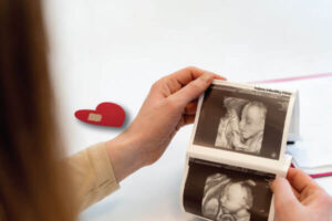Pregnancy After Miscarriage.