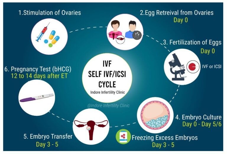 What is ICSI ? Cost of ICSI ? How is IVF with ICSI done?