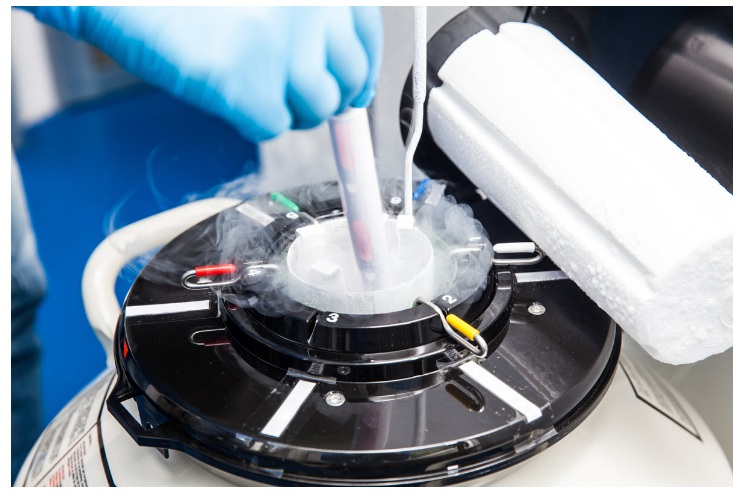 oocyte freezing / egg freezing