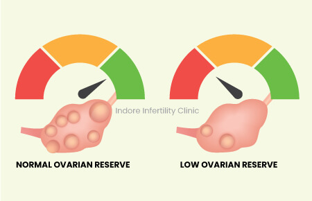 low ovarian reserve vs normal ovarian reserve