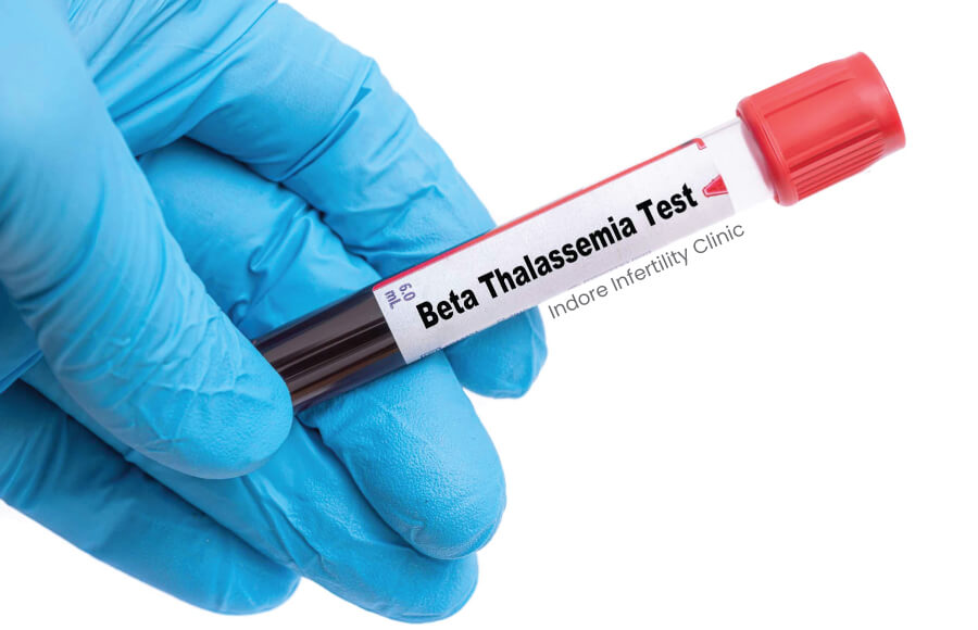 Beta Thalassemia Test