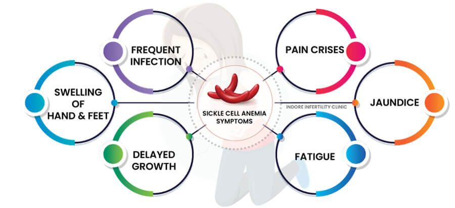 SickleCellDisease