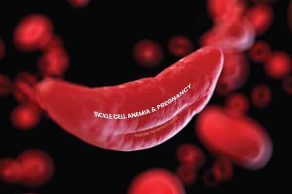 Sickle-Cell Anaemia, Fertility &  Pregnancy