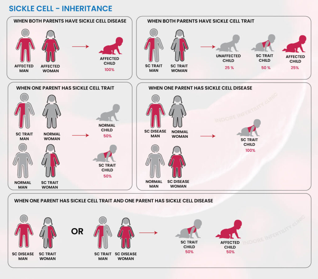 SickleCellDiseaseInheritance