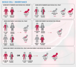 SickleCellDiseaseInheritance