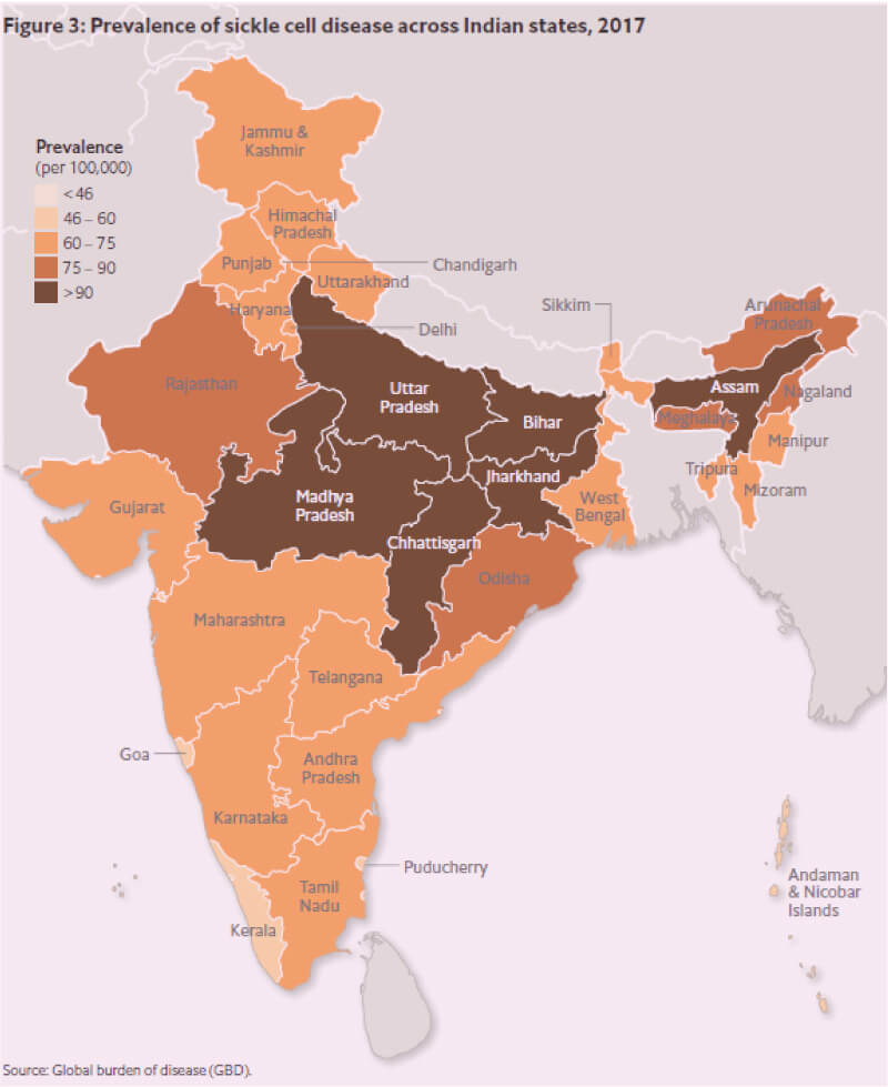 sickle cell anemia in india