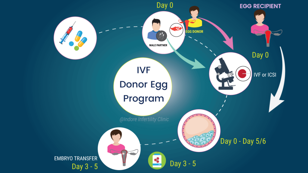 IVF Donor Egg Process