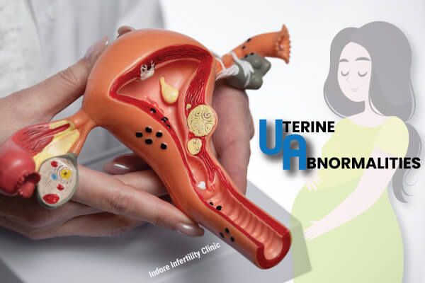 Pregnancy with Uterine Abnormalities